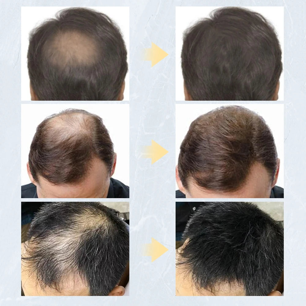 Hair Fiber Spray - Supersell