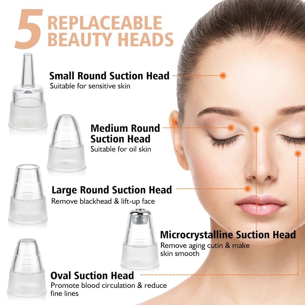 Blackhead Remover Vacuum – Facial Deep - Cleansing Pore Cleaner - Supersell