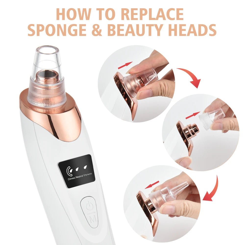 Blackhead Remover Vacuum – Facial Deep - Cleansing Pore Cleaner - Supersell