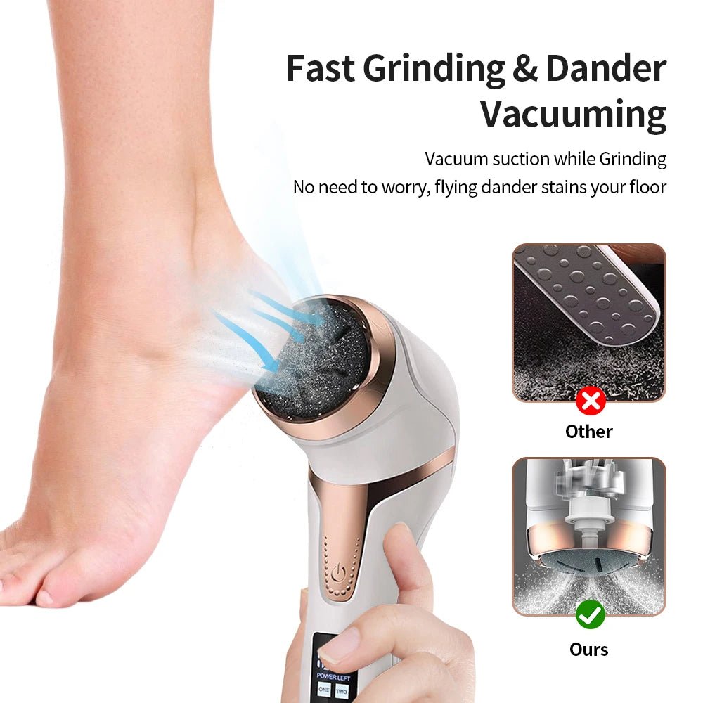 Electric Foot Callus Remover – Rechargeable Pedicure Tool - Supersell