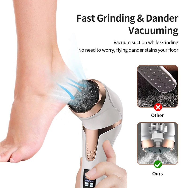 Electric Foot Callus Remover – Rechargeable Pedicure Tool - Supersell